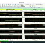 Learn More About SonoLab